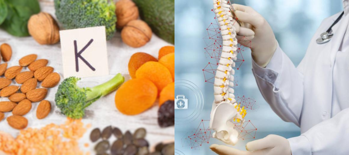 osteoporosis