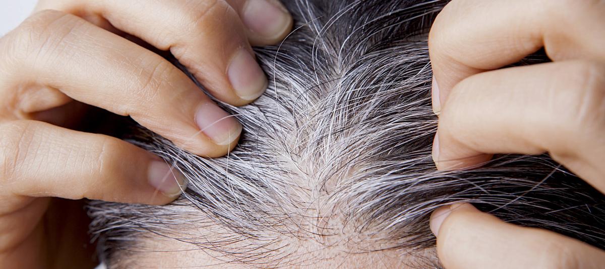 Qué pasa si se arranca las canas? Mitos y verdades explicados por expertos  médicos