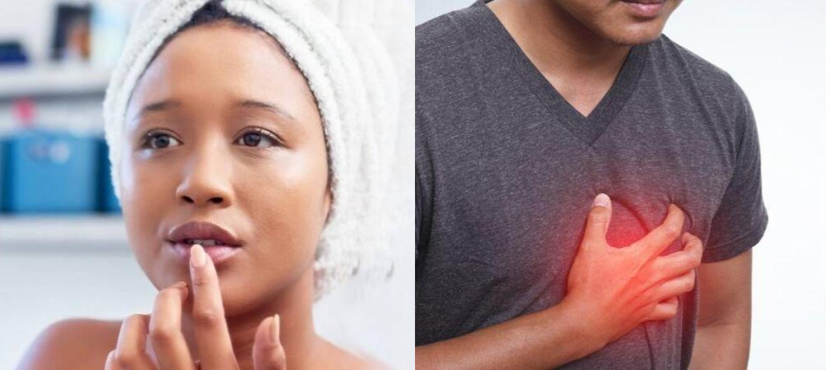 El síntoma en los labios que podría alertarlo sobre una enfermedad cardíaca