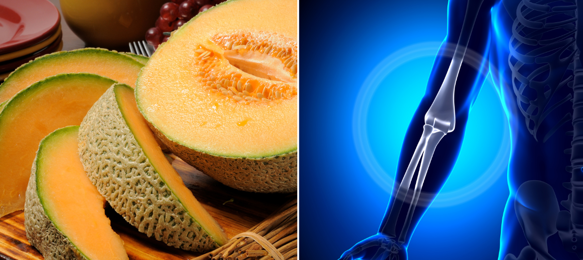 Melón