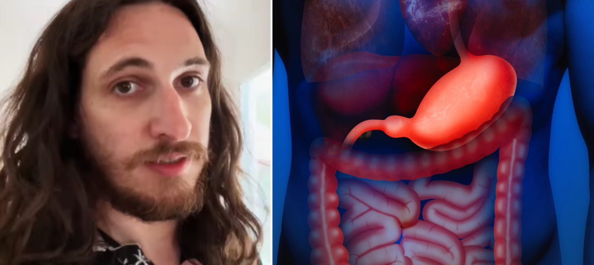 Cáncer de estómago