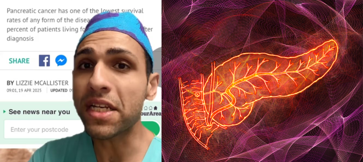 Cáncer de páncreas