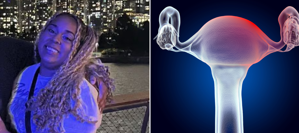 Cáncer de útero experiencia