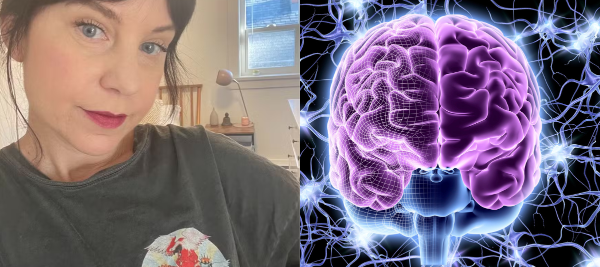 Cerebro