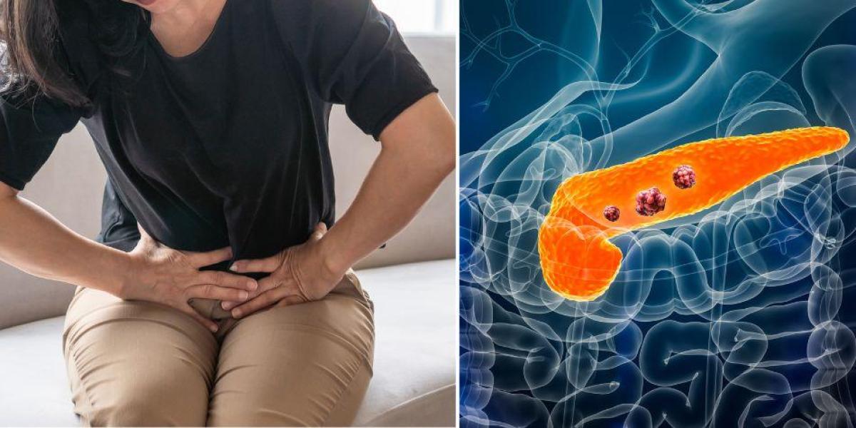 Cáncer de páncreas uno de los más mortales.