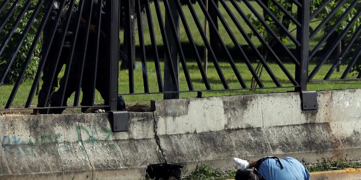 Luis Vallenilla, de 22 años, recibió un disparo a quemarropa por parte de la Guardia Nacional Bolivariana en una protesta en contra del gobierno.