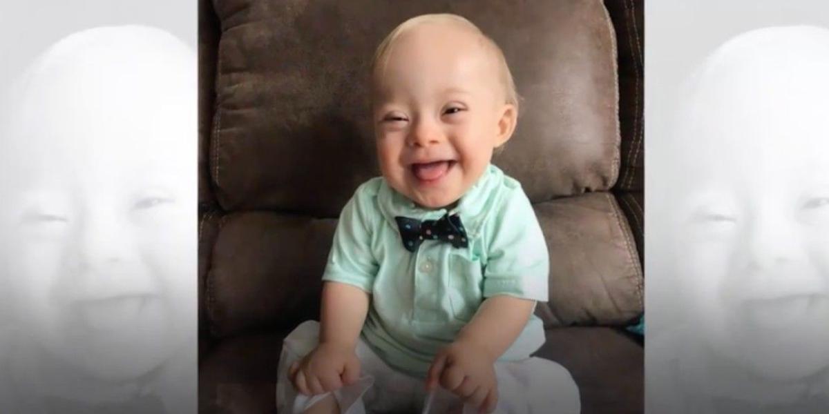 El primer bebé con síndrome de down es la imagen de la marca Gerber