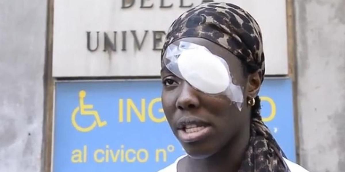 La atleta fue traslada immediatamente a un hospital de Turín, de donde salió este lunes con un vendaje sobre el ojo izquierdo.