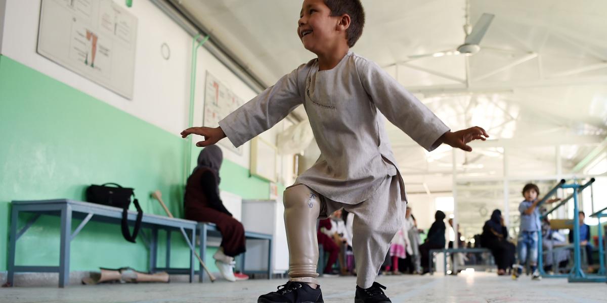 El niño, Ahmad Sayed Rahman, de cinco años, conmovió al mundo después de que en un video aparece bailando sin esfuerzo con su nueva pierna fue publicado esta semana en Twitter.