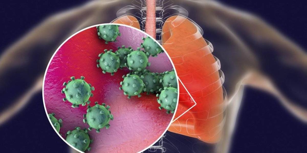 El coronavirus puede causar lesiones severas en los pulmones.