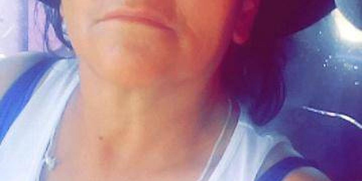 María Emilia Cadena, de 66 años, se enfermó el día 14 de octubre de 2020.