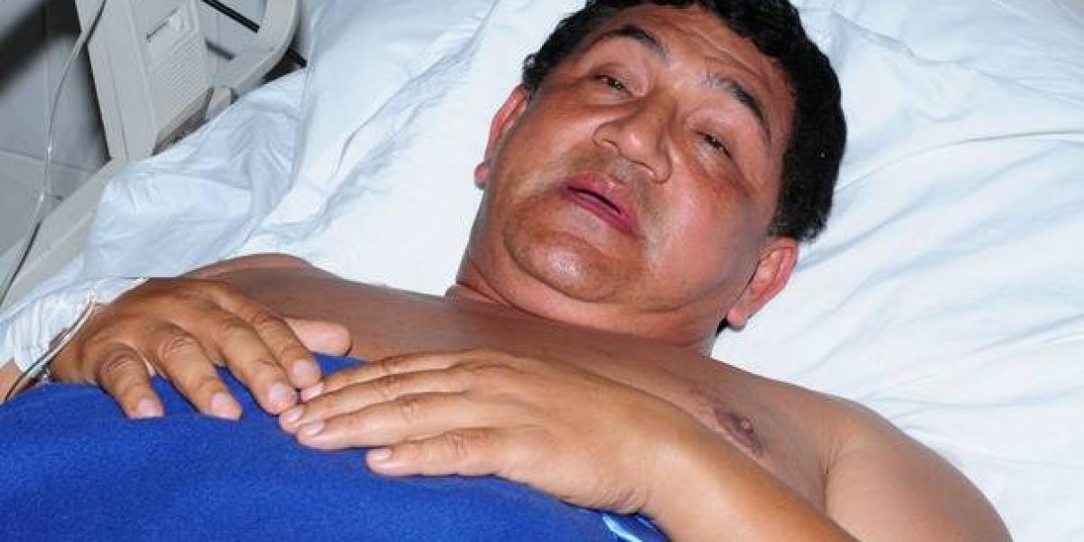'El pulmón de oro' se recupera en una clínica de Valledupar.