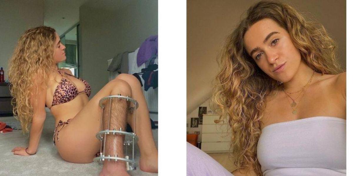 Londres: No se depila su pierna por accidente y ya es viral en redes