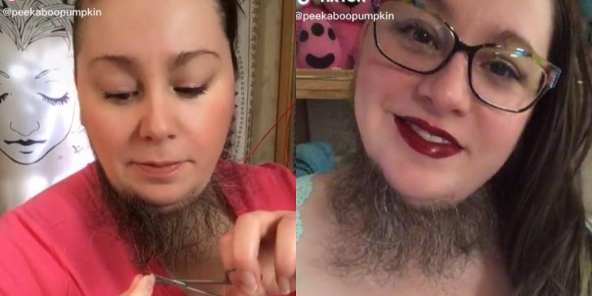 La mujer es popular por mostrar su barba en redes sociales.