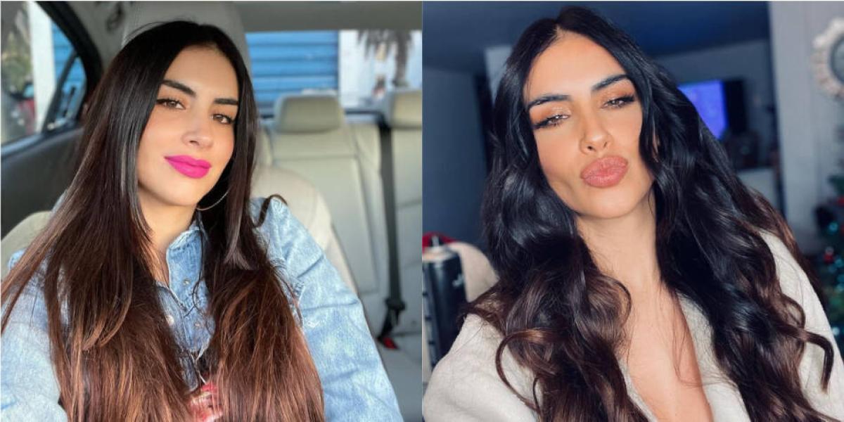 Jessica Cediel mostró cómo fue su cirugía de biopolímeros