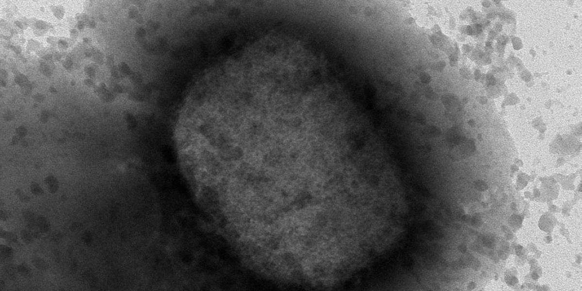 Imagen Mokeypox microscopía electrónica.