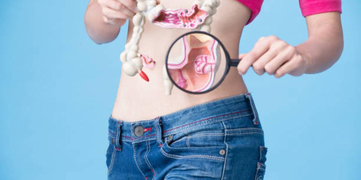 El cáncer de colon genera células malignas en el aparato digestivo.