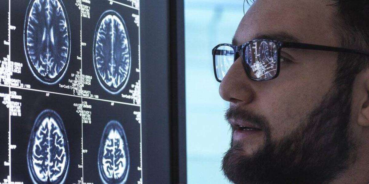 BBC Mundo: Un doctor examina imágenes escaneadas de un cerebro