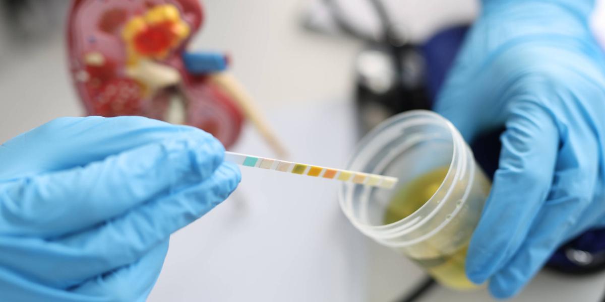 Determinacion De Acido Urico En Orina www.eltiempo.com