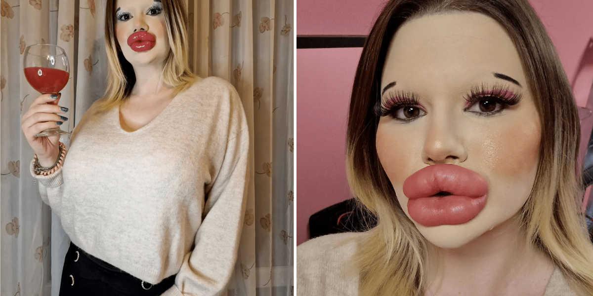 Andrea Ivanova mujer con labios más grandes del mundo quiere más pómulos