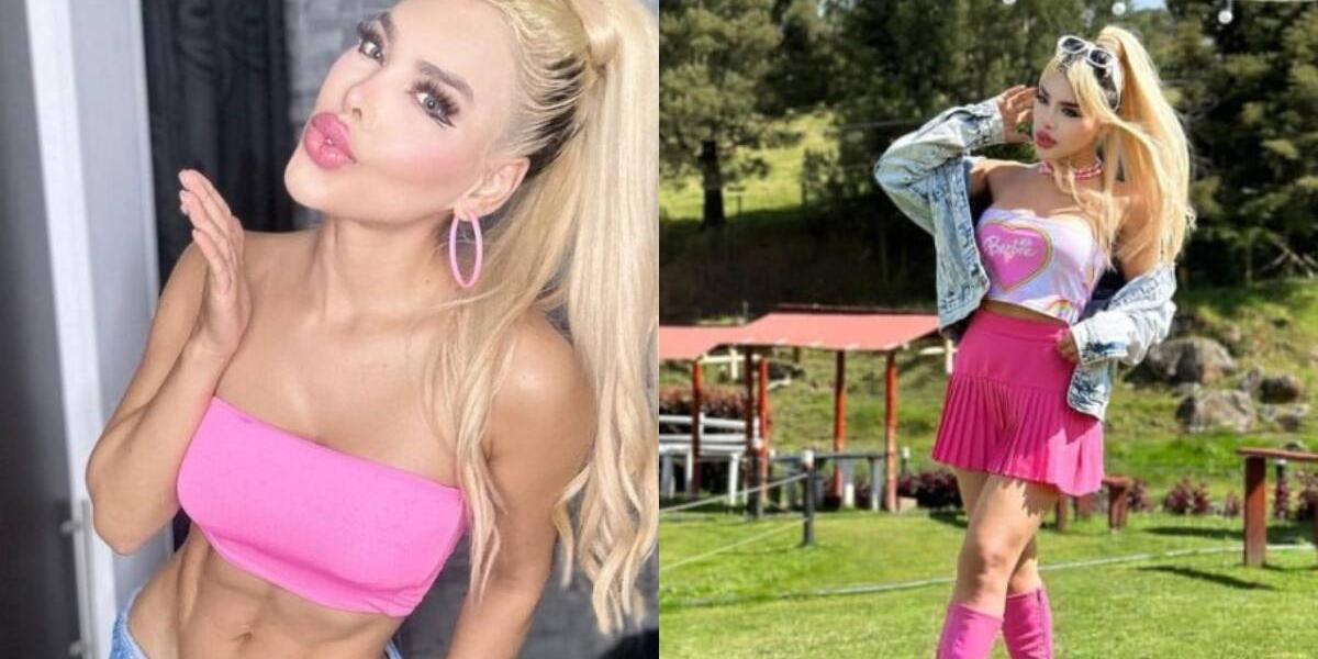 Fotos asi se veia la Barbie colombiana antes de sus cirugias