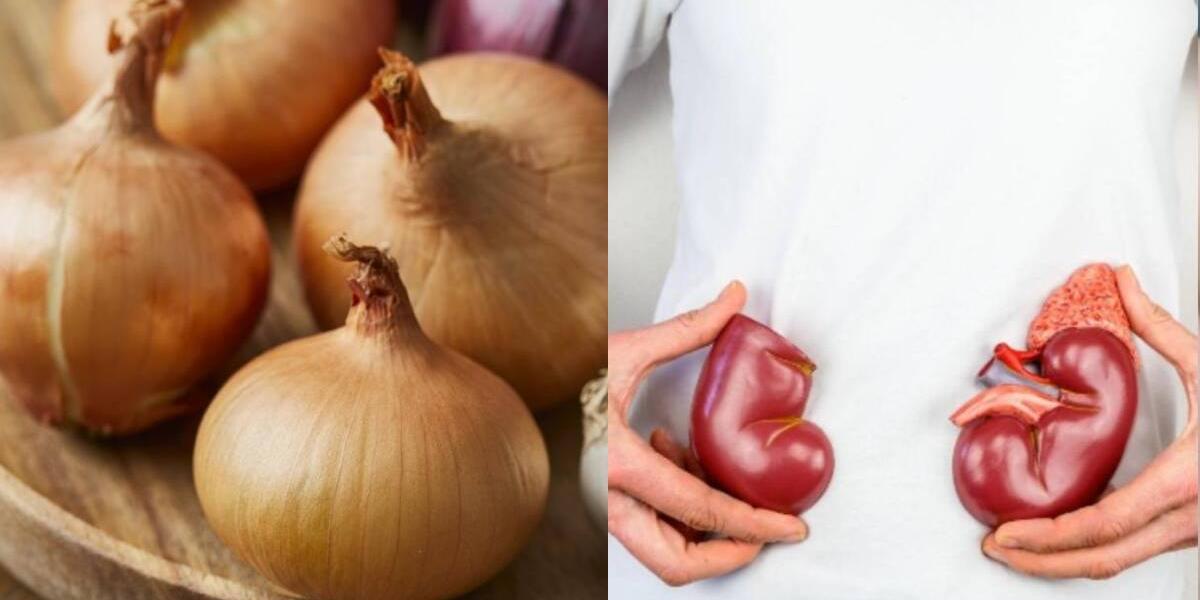 Comer cebolla a diario podr a cuidar los ri ones estos son los