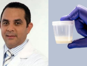 Urólogo explica qué significa la presencia de sangre en el semen o hemospermia y cuándo es necesario ir al médico
