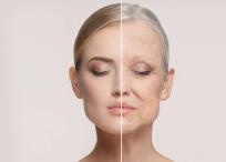 Según la experta, los procesos que ponen en marcha el envejecimiento empiezan entre los 25 y los 30.