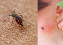 Es indispensable cuidar muy bien la superficie de nuestra piel, como el rostro, piernas y brazos.