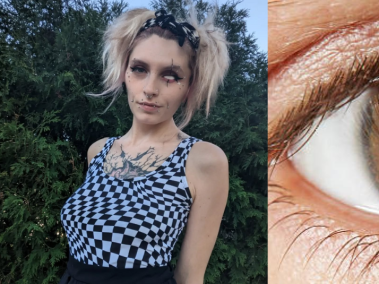 cáncer ocular