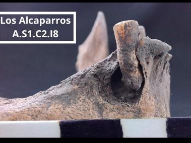 Caries y desnutrición: así era la salud de los pobladores de la Sabana de Bogotá hace 6.000 años