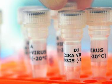 Un empleado examina los tubos con la etiqueta "virus Zika ' en Genekam Biotecnología AG en Duisburg , Alemania 2 de febrero de 2016.