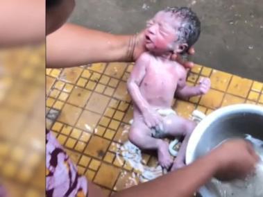 Las desgarradoras imágenes de un bebé recién nacido rescatado de una alcantarilla