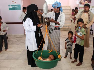 Niño yemenita que sufre de desnutrición se pesa en un hospital en el distrito norteño de Abs en la provincia noroccidental de Hajjah.