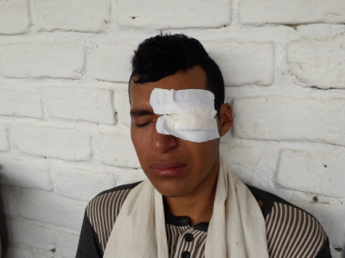 Lesionado en protesta en carretera Panamericana en Cauca