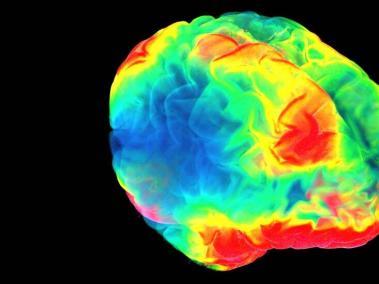 BBC Mundo: Escáner de un cerebro