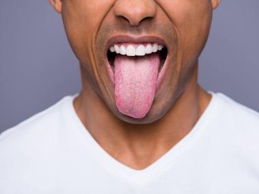 Generalmente tener la lengua blanca puede llegar a ser inofensivo.