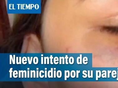 Los hecho ocurrieron en la localidad de Ciudad Bolívar. La presunta pareja de la víctima la habría golpeado en su estómago.