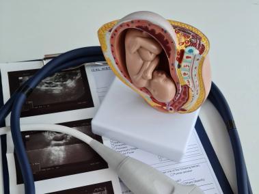 Ojo, debe ir al ginecólogo por lo menos una vez al año.