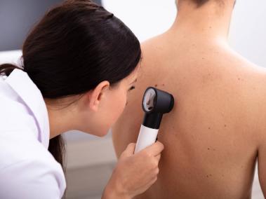 Si detecta una lesión en la piel, es importante que acuda a un dermatólogo.