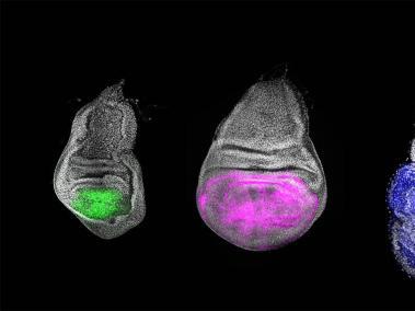 La ausencia de Chinmo en las células imaginales suprime el crecimiento del ala (izda) comparado con el tejido precursor del ala control (centro), mientras que la sobreexpresión del gen Chinmo induce un sobrecrecimiento del tejido, tal y como sucede en los procesos tumorales (dcha).