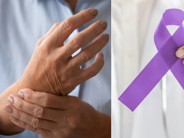 El lupus es una enfermedad autoinmune.