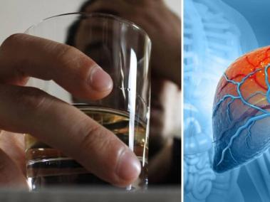 Dejar de tomar alcohol es una buena idea para cuidar el hígado.