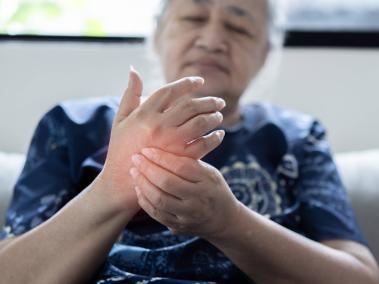 El tratamiento de la artritis séptica dura entre dos y seis semanas.