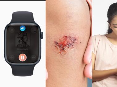 Si el Apple Watch detecta que usted no se mueve, en 30 segundos llamará a emergencias.