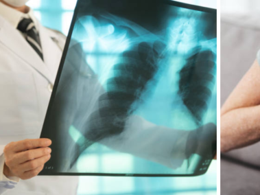 tuberculosis