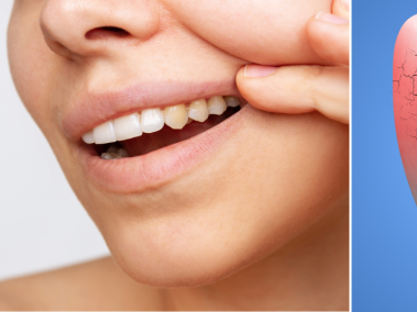 Dientes