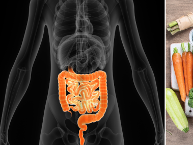 Cáncer de colon y alimentación saludable