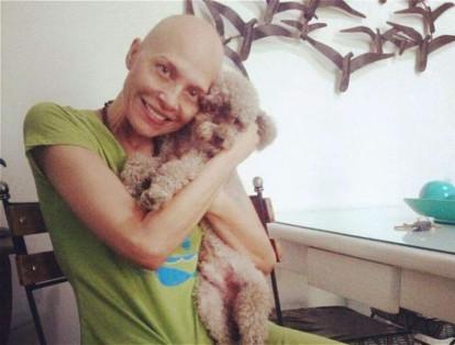En Instagram, por ejemplo, publicó fotos y videos donde se evidenció el cambio en su aspecto físico a causa de la quimioterapia y las operaciones.