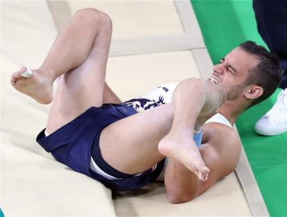 El gimnasta francés Samir Ait Said sufrió una grave fractura en su pierna izquierda al intentar el salto de caballo en la prueba clasificatoria de gimnasia artística.